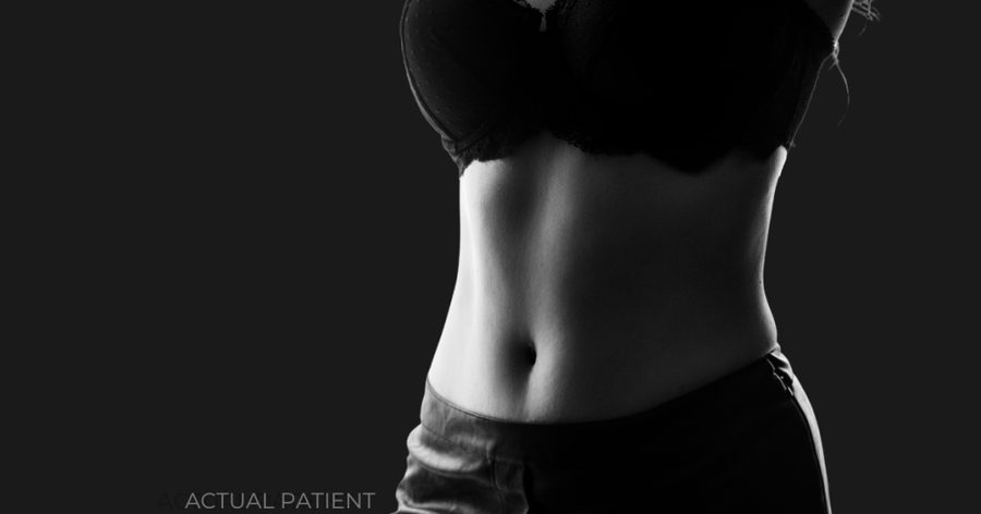 How Many Sessions of EMSCULPT® Do You Need? Take Our Quiz! | Piazza Center for Plastic Surgery and Advanced Skin Care