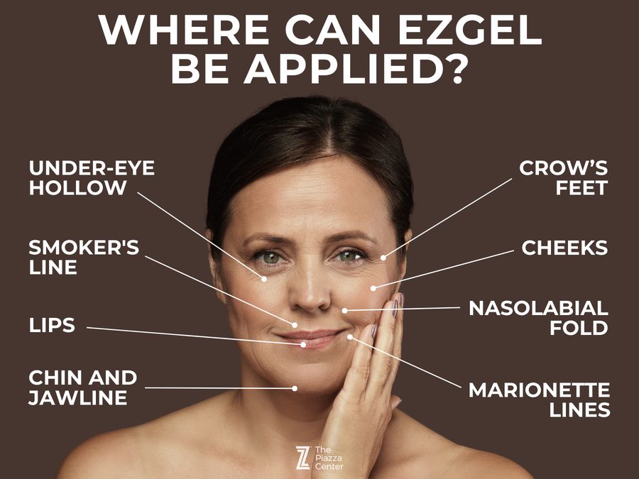 Where ezGEL can be applied parts of the face you can inject ezGEL